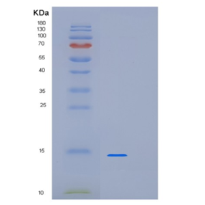 Recombinant Human LSM3 Protein,Recombinant Human LSM3 Protein