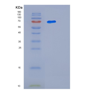 Recombinant Human LTA4H Protein