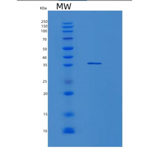 Recombinant Human LUM Protein,Recombinant Human LUM Protein