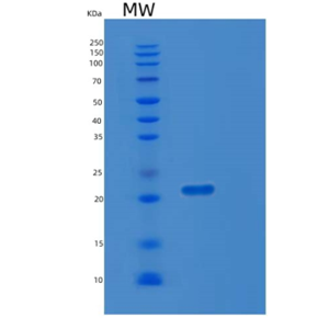 Recombinant Human LZIC Protein,Recombinant Human LZIC Protein