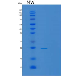 Recombinant Human MAFG Protein,Recombinant Human MAFG Protein