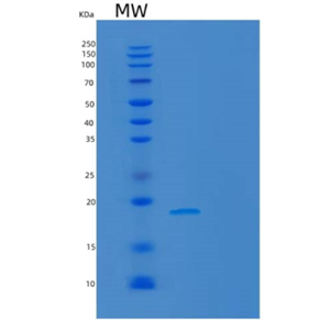 Recombinant Human MAFK Protein,Recombinant Human MAFK Protein