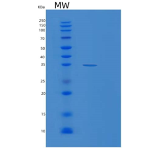 Recombinant Human MAGEA6 Protein