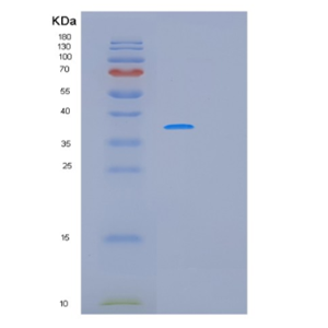 Recombinant Human MAGEA8 Protein,Recombinant Human MAGEA8 Protein