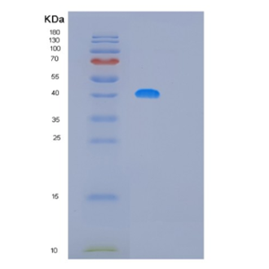 Recombinant Human MAGEB10 Protein,Recombinant Human MAGEB10 Protein