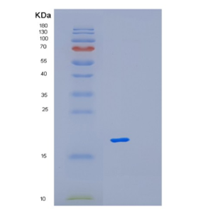 Recombinant Human MAGOH Protein,Recombinant Human MAGOH Protein