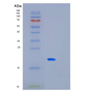 Recombinant Human MAGOHB Protein,Recombinant Human MAGOHB Protein