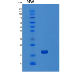 Recombinant Human MAP1LC3B Protein,Recombinant Human MAP1LC3B Protein