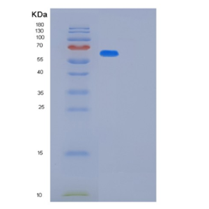 Recombinant Human MAVS Protein,Recombinant Human MAVS Protein