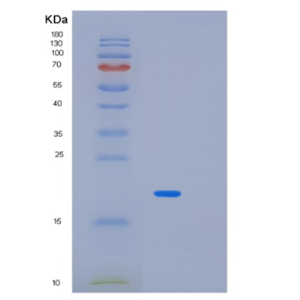 Recombinant Human MAX Protein,Recombinant Human MAX Protein