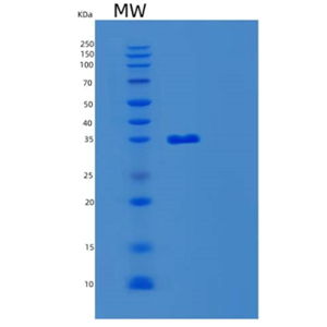 Recombinant Human MBD3 Protein,Recombinant Human MBD3 Protein