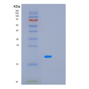 Recombinant Human MBL2 Protein,Recombinant Human MBL2 Protein