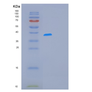 Recombinant Human MCL1 Protein