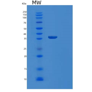 Recombinant Human MDH1 Protein