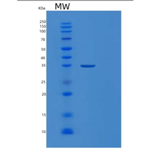 Recombinant Human MDH2 Protein