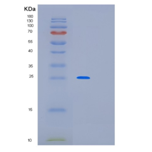 Recombinant Human MED20 Protein