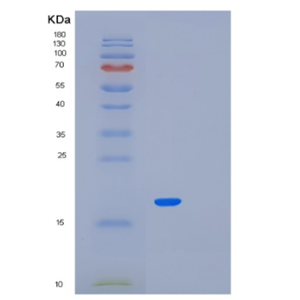 Recombinant Human MED21 Protein