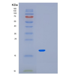 Recombinant Human MED21 Protein,Recombinant Human MED21 Protein