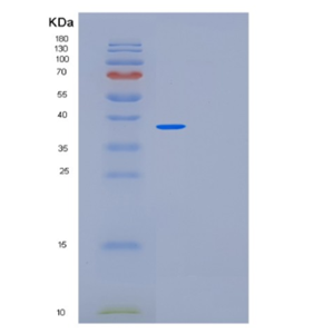 Recombinant Human MED27 Protein