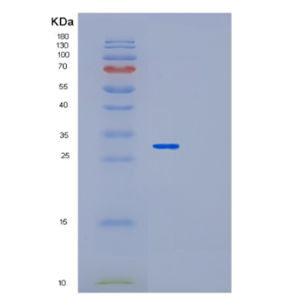 Recombinant Human MED4 Protein