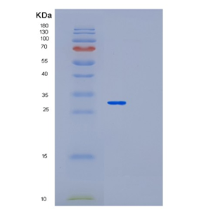 Recombinant Human MED4 Protein,Recombinant Human MED4 Protein