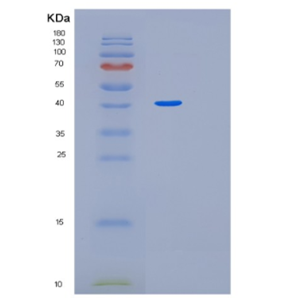 Recombinant Human MEIS3 Protein