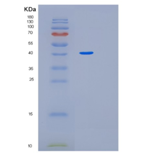 Recombinant Human MEIS3 Protein,Recombinant Human MEIS3 Protein