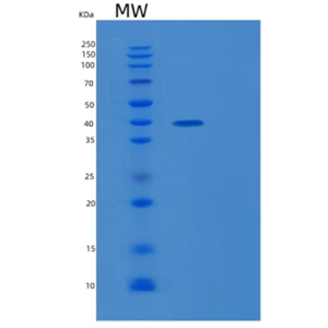 Recombinant Human MESDC1 Protein,Recombinant Human MESDC1 Protein