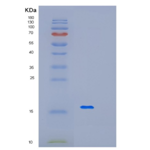 Recombinant Human MFAP3 Protein,Recombinant Human MFAP3 Protein