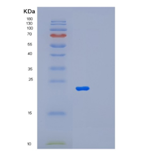 Recombinant Human MFAP2 Protein,Recombinant Human MFAP2 Protein