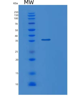 Recombinant Human MGLL Protein,Recombinant Human MGLL Protein