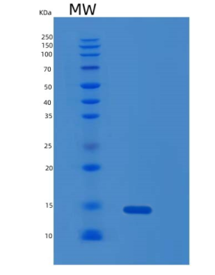 Recombinant Human MIA Protein,Recombinant Human MIA Protein