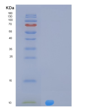 Recombinant Human MLANA Protein,Recombinant Human MLANA Protein