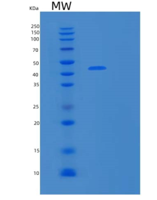 Recombinant Human MMP13 Protein,Recombinant Human MMP13 Protein