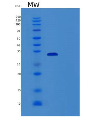 Recombinant Human MPG Protein,Recombinant Human MPG Protein