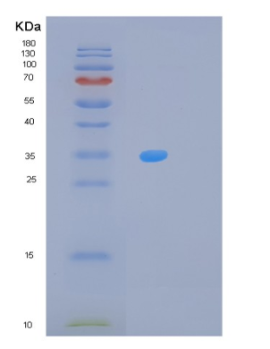 Recombinant Human MPST Protein,Recombinant Human MPST Protein