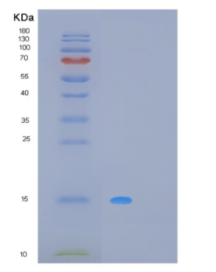 Recombinant Human MPZL1 Protein,Recombinant Human MPZL1 Protein