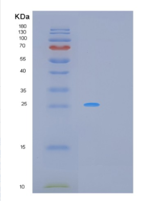 Recombinant Human MRAS Protein,Recombinant Human MRAS Protein