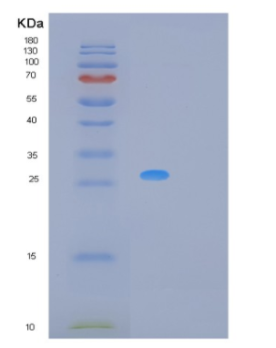 Recombinant Human MREG Protein,Recombinant Human MREG Protein