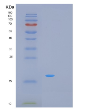 Recombinant Human MRFAP1L1 Protein,Recombinant Human MRFAP1L1 Protein