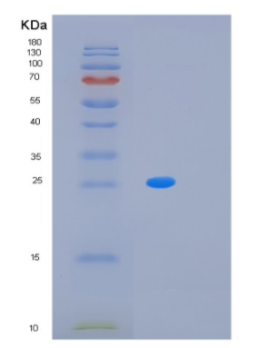 Recombinant Human MRGBP Protein,Recombinant Human MRGBP Protein