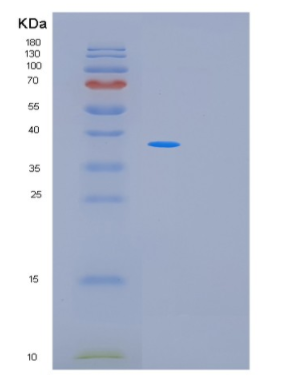 Recombinant Human MRM1 Protein,Recombinant Human MRM1 Protein