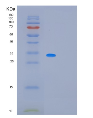 Recombinant Human MRPL1 Protein,Recombinant Human MRPL1 Protein