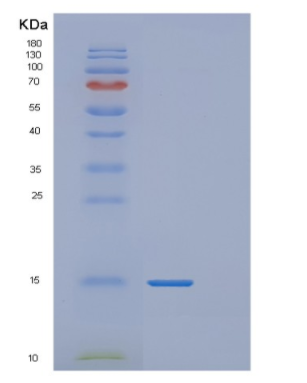 Recombinant Human MRPL2 Protein,Recombinant Human MRPL2 Protein