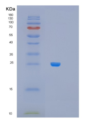 Recombinant Human MRPL28 Protein,Recombinant Human MRPL28 Protein