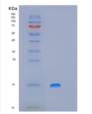 Recombinant Human MRPS28 Protein,Recombinant Human MRPS28 Protein