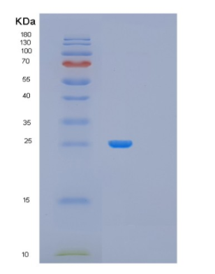 Recombinant Human MRRF Protein,Recombinant Human MRRF Protein