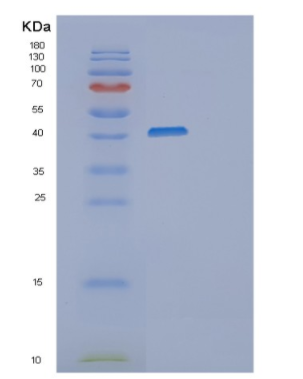 Recombinant Human MSR1 Protein,Recombinant Human MSR1 Protein