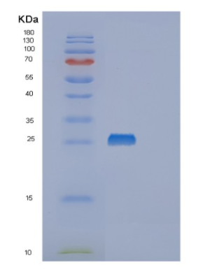 Recombinant E.coli msrA Protein,Recombinant E.coli msrA Protein