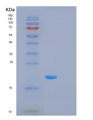Recombinant Human MSRB2 Protein,Recombinant Human MSRB2 Protein